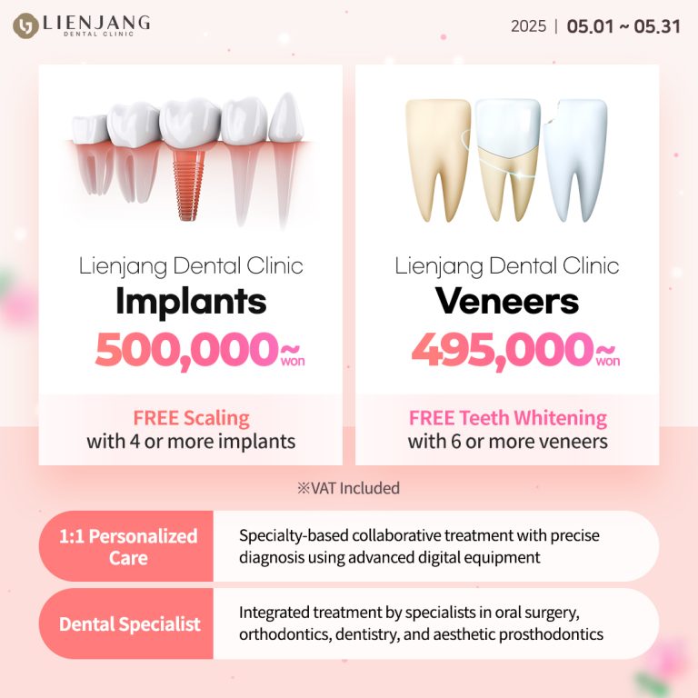 one day veneers in seoul